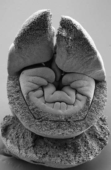 Young flower of Napoleonaea vogelii (Lecythidaceae), SEM.